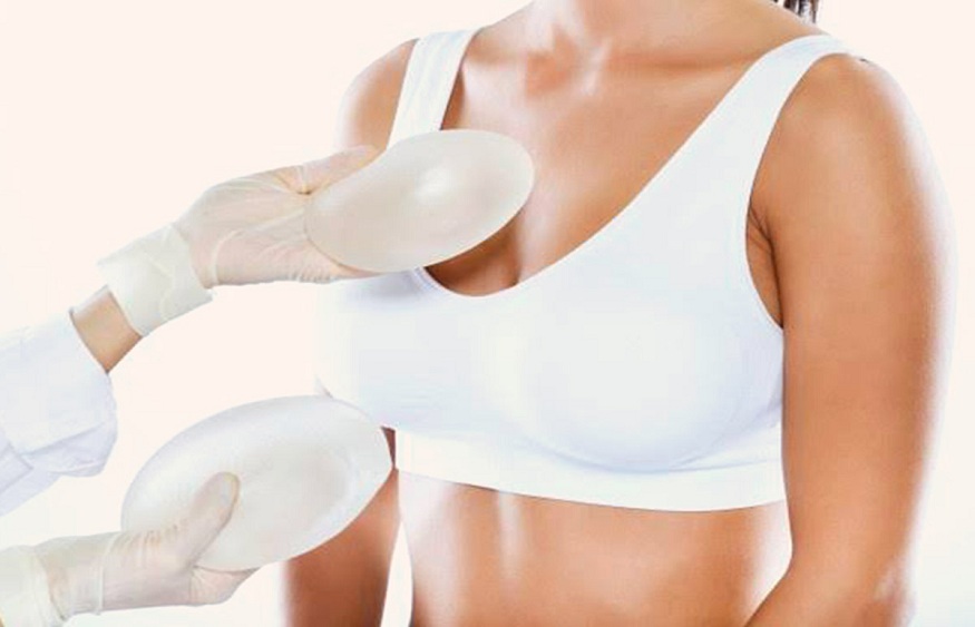 6 You Must Know About Breast Augmentation